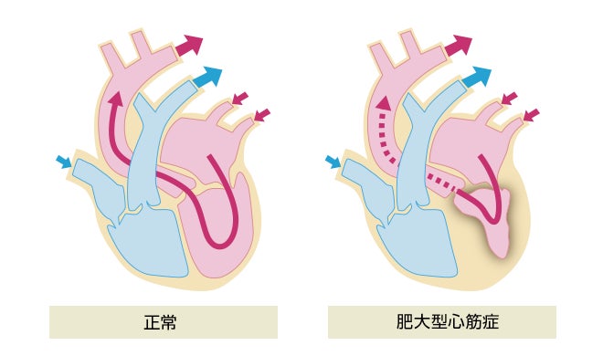 セブン銀行共同ATMの設置について